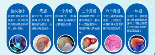 国家专利软肝治疗系统&mdash;&mdash;轻松逆转肝硬化