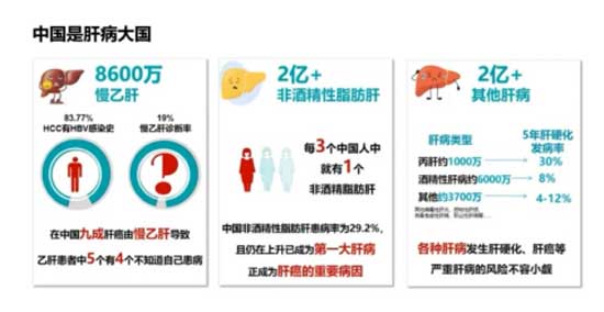 河南省启动全国慢性肝病大型查治双扶活动
